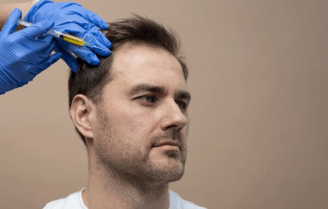 Achieve Natural Looking Hair with Hair Transplant in Turkey Hair transplant in Turkey